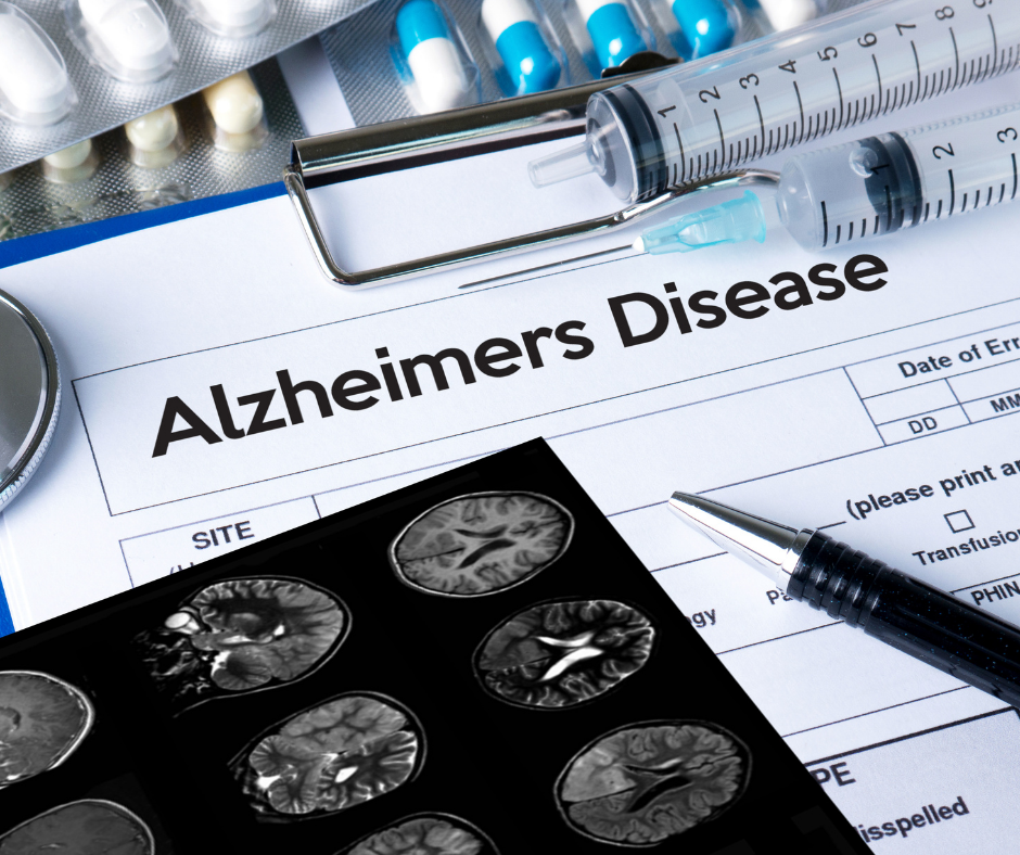 Understanding Alzheimer’s Disease